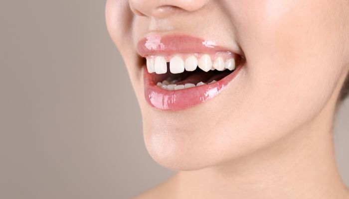 Learn Facts about Ladies with Gap Teeth